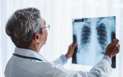 3 razones para dejar de usar la radiografía como método de comprobación del acceso venoso central pediátrico