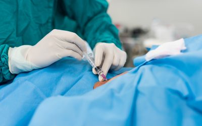 ¿Sabías qué… el material del catéter arterial influye en la calidad de la onda de presión arterial?