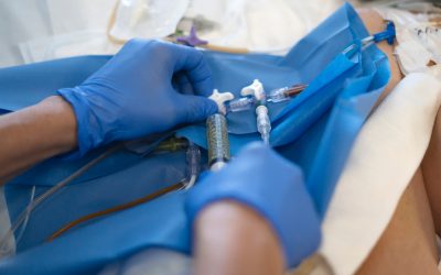 3 Motivos por los que dejar de suturar un acceso vascular