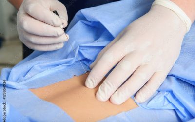 Las complicaciones asociadas a la localización del espacio epidural