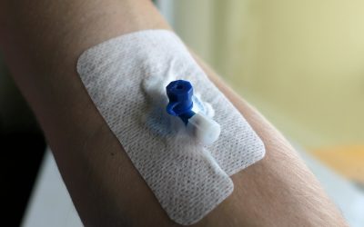 Cuándo y cómo y  usar la fijación con anclaje subcutáneo