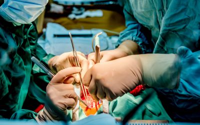 Monitorización hemodinámica en la cirugía de aorta ascendente y arco aórtico