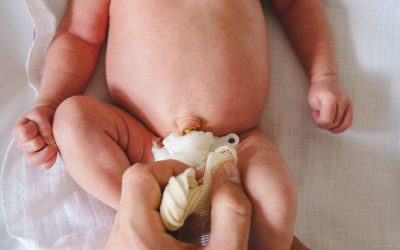 Inserción segura de catéteres umbilicales ¿Cuáles son las ultimas recomendaciones para una mejor atención neonatal?