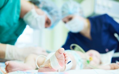 4 Claves para evitar la isquemia asociada a la cateterización arterial