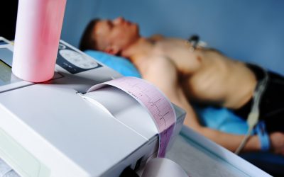 4 razones por las que usar el método ECG-IC en la colocación de reservorios
