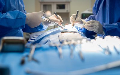 Sarcomas retroperitoneales, ¿Cómo mejorar el pronóstico de los pacientes?