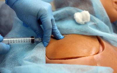 13 claves para evitar complicaciones asociadas a la canalización de la vena subclavia
