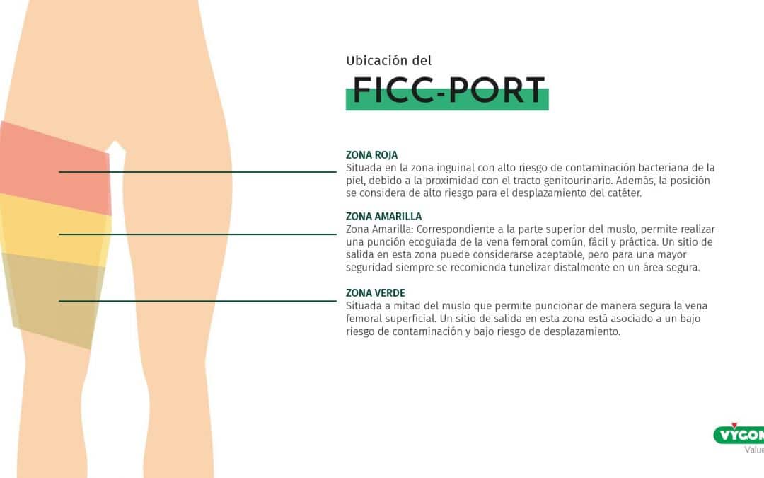 Ubicación del FICC-Port