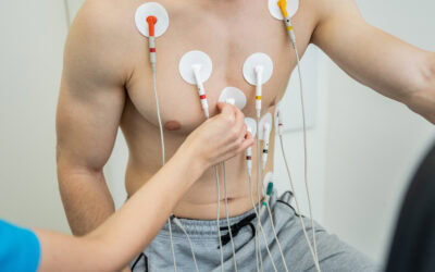 Cómo interpretar el ECG a la hora de colocar un catéter PICC