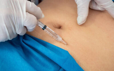 Claves para realizar un buen bloqueo del nervio femoral