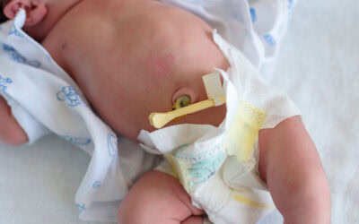 ¿Qué introductor elegir para la canalización de PICCs neonatales?