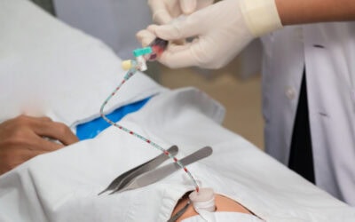 Infecciones relacionadas con el catéter en Neonatos