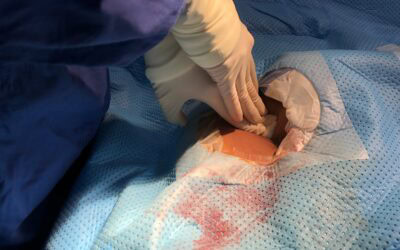 WoCoVA Live! 5 recomendaciones claves sobre la gestión del acceso vascular en pacientes Covid