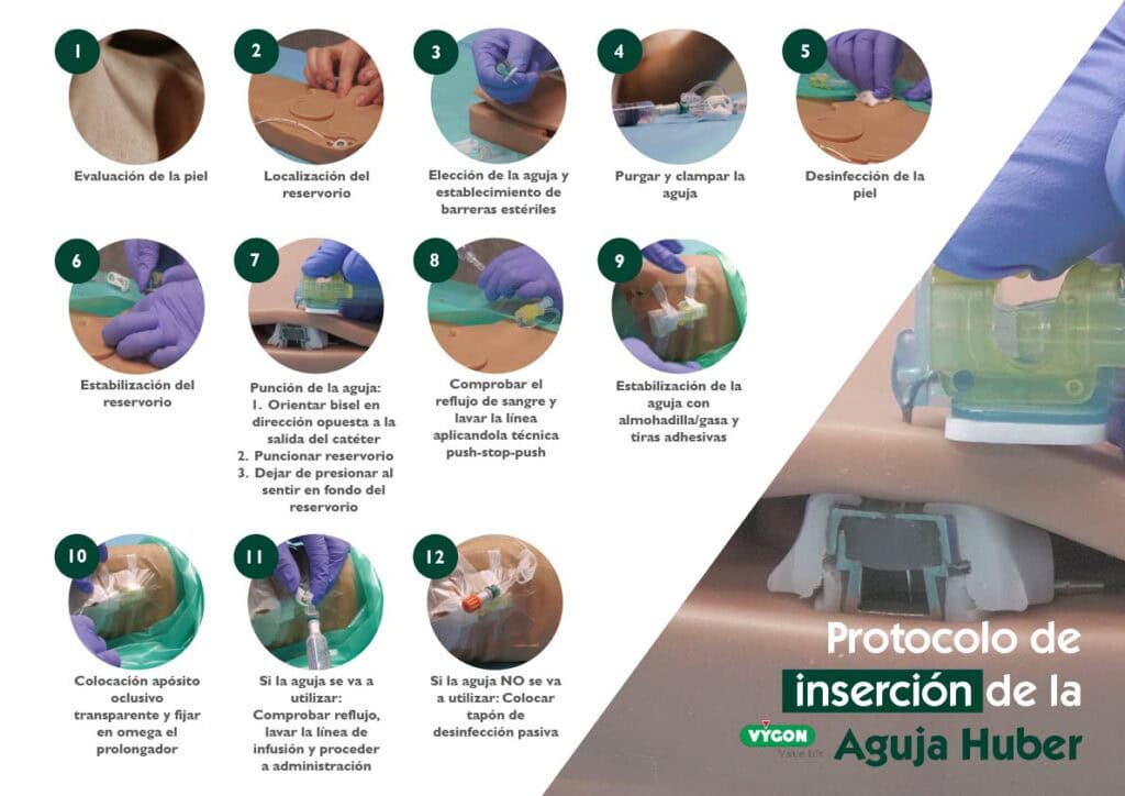 POSTER AGUJAS HUBER - INSERCIÓN