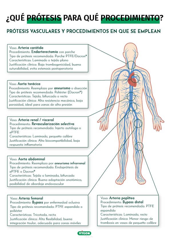 Mapa de aplicaciones clínicas de cada tipo de prótesis vascular