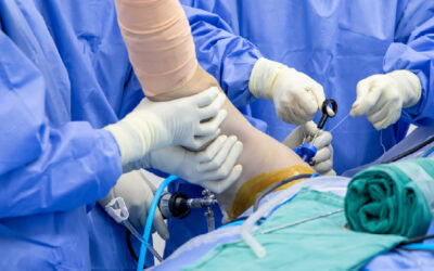 ¿Hay vida más allá del interescalénico? Abordajes para artroscopia de hombro.