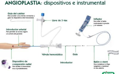 Angioplastia: dispositivos y material