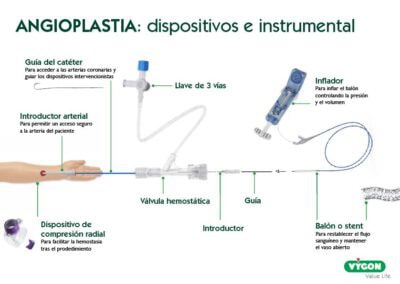 Angioplastia: dispositivos y material