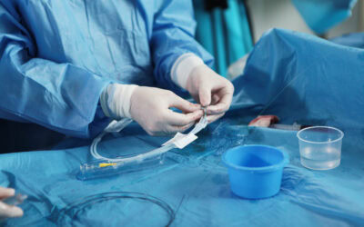 Tratamiento del aneurisma: quirúrgico o endovascular. Comparativa e indicaciones