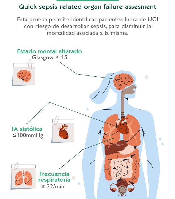 qSOFA. Quick sepsis-related organid failure assesment