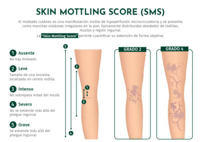 Skin Mottling Score