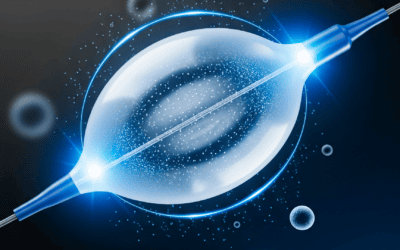 Más allá del stent: El papel clave del balón en cardiología intervencionista moderna