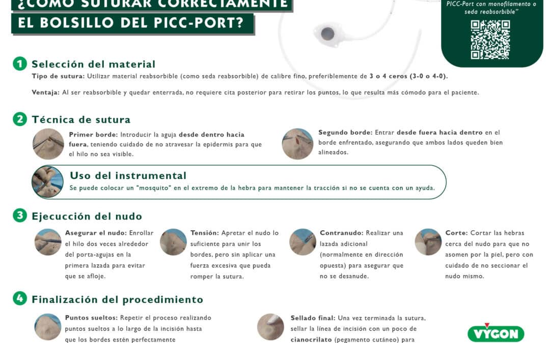 Sutura del bolsillo del PICC-Port