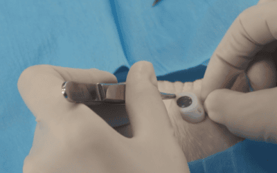 Implantación de PICC-Port con fluoroscopia: una técnica alternativa al reservorio torácico para los equipos de radiología