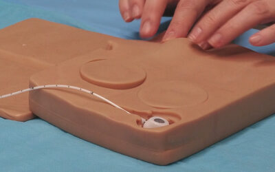 Criterios de selección del PICC-Port: ¿Cuándo es la mejor opción?