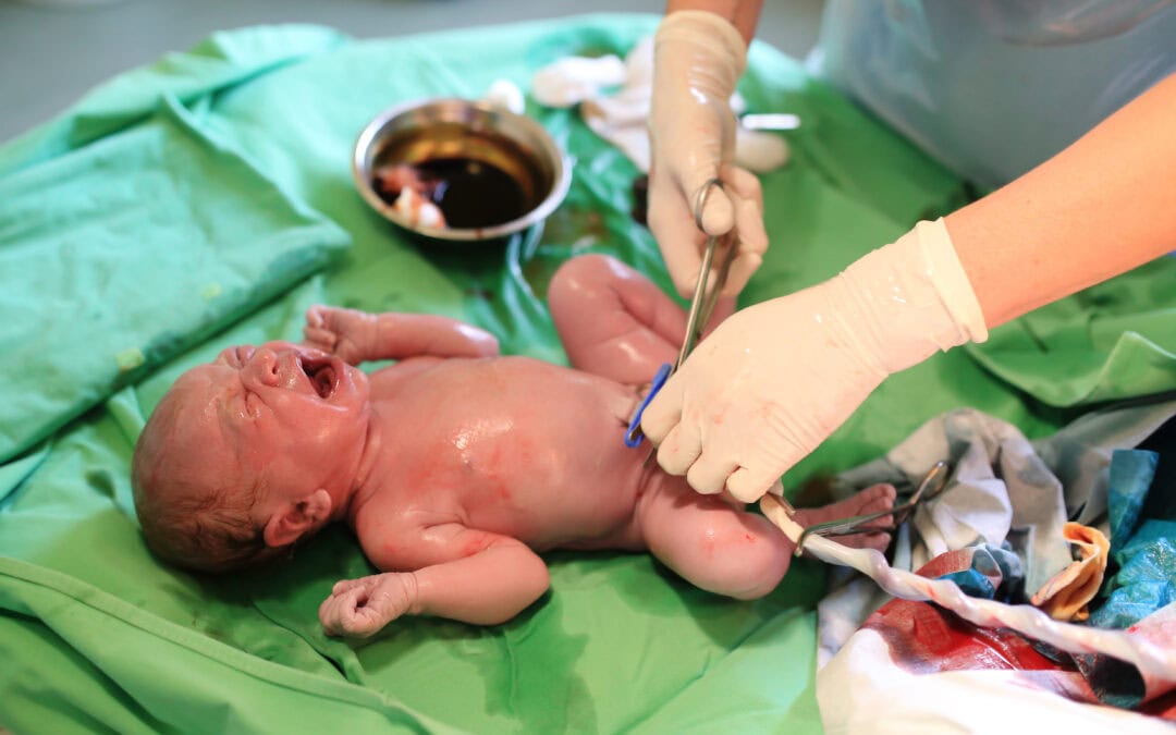 Tips para mejorar las prácticas en la colocación del catéter umbilical en el paciente prematuro