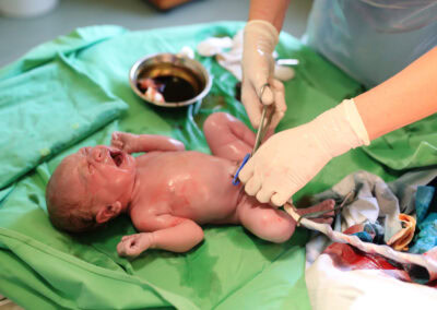 Tips para mejorar lasprácticas en la colocación del catéter umbilical en el paciente prematuro