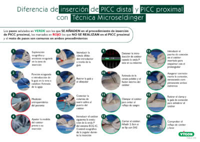 Diferencia de inserción de PICC distal y PICC proximal con Técnica Microseldinger