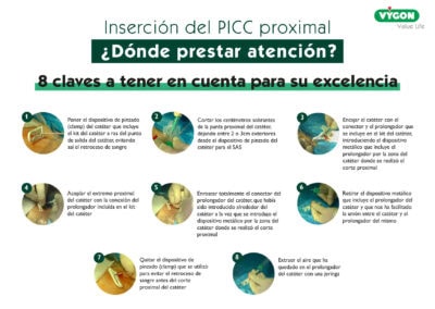 Catéter de corte proximal: ¿Dónde prestar atención?
