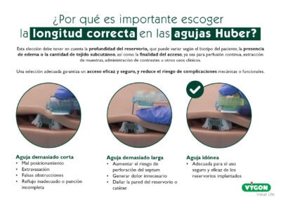 ¿Por qué es importante escoger la longitud correcta en las agujas Huber?