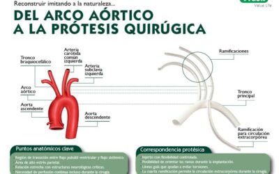 Del arco aórtico a la prótesis quirúrgica