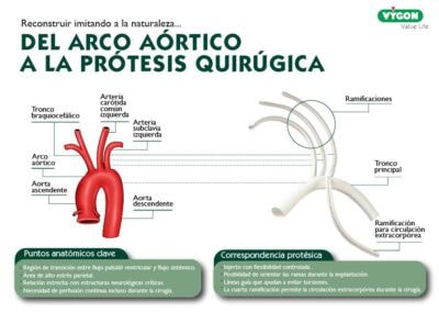 Del arco aórtico a la prótesis quirúrgica