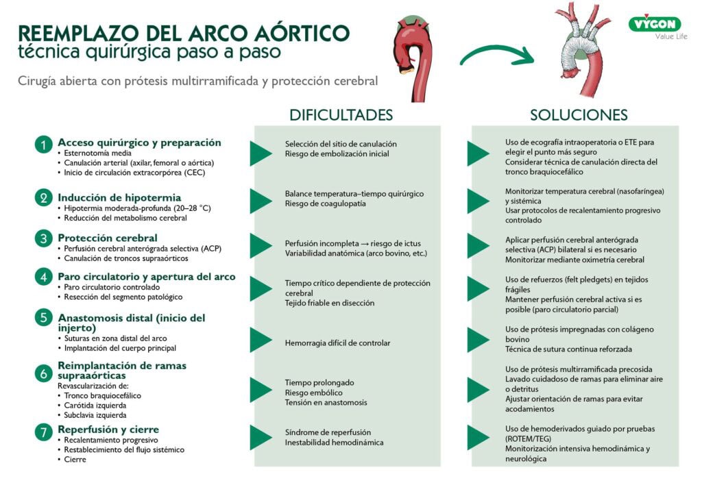 Reemplazo del arco aórtico