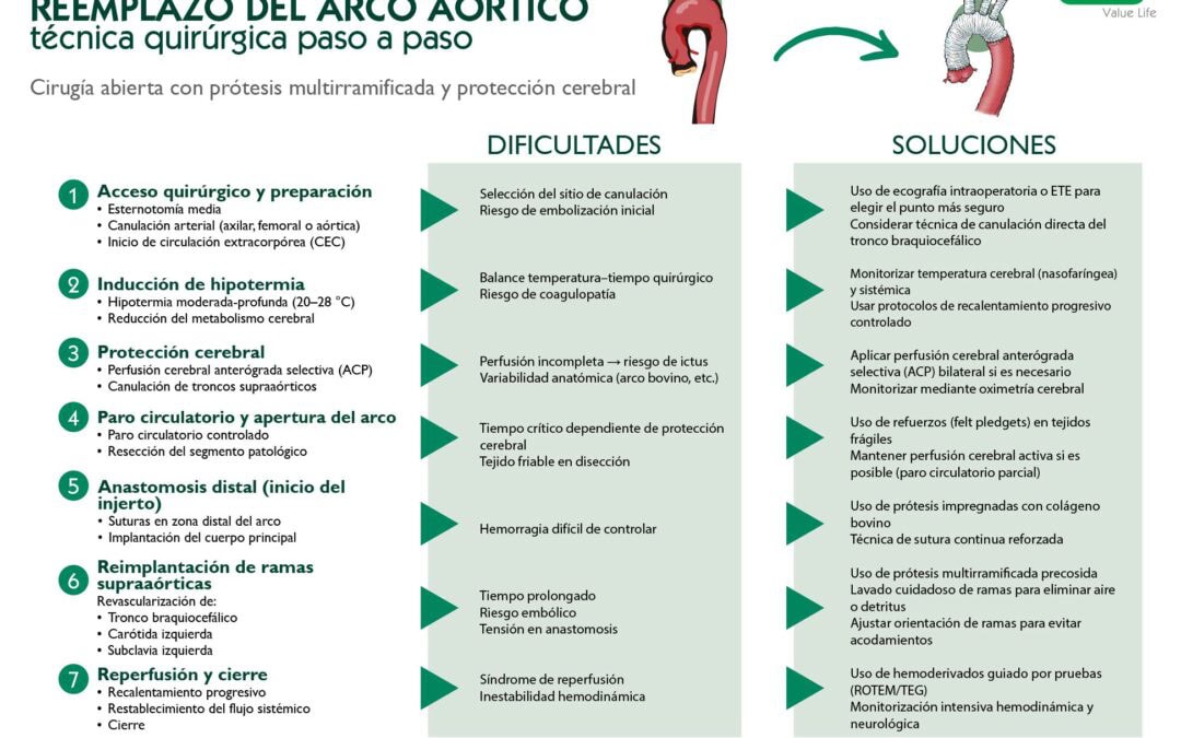Reemplazo del arco aórtico por una prótesis
