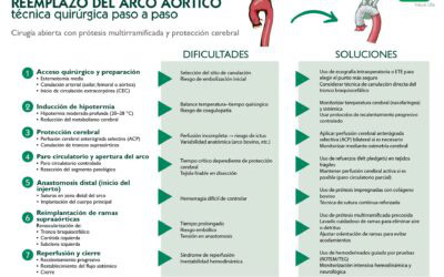 Reemplazo del arco aórtico por una prótesis