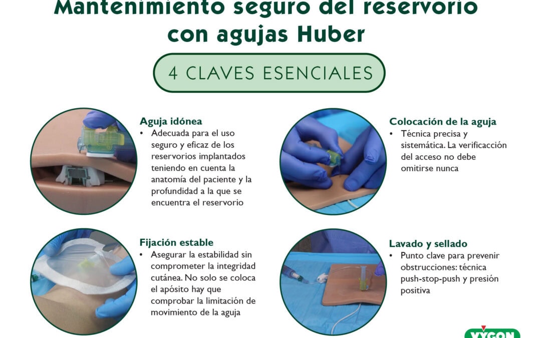Mantenimiento seguro del reservorios con agujas Huber: 4 claves esenciales
