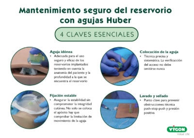 Mantenimiento seguro del reservorios con agujas Huber: 4 claves esenciales