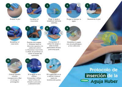 Inserción Aguja Huber