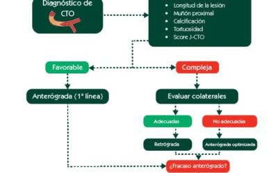 Anterógrado o retrógrado. Algoritmo de decisión para acceso radial en CTO