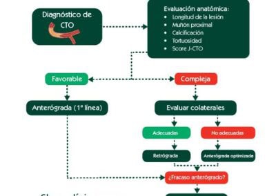 Anterógrado o retrógrado. Algoritmo de decisión para acceso radial en CTO