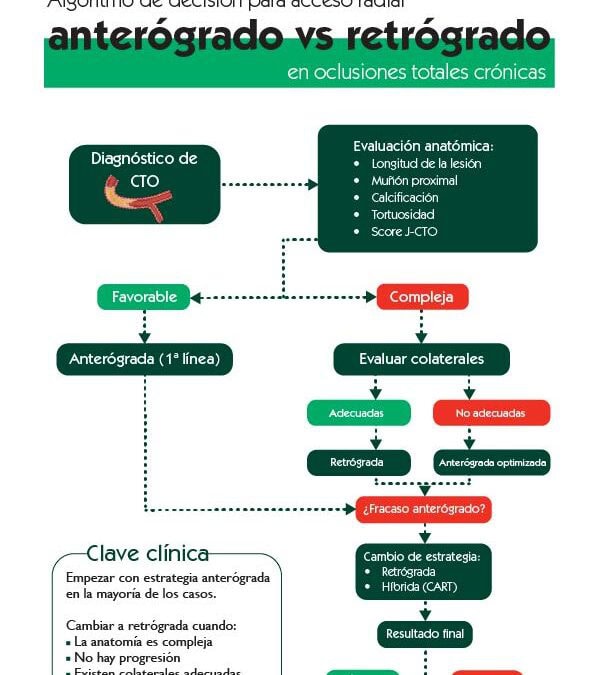 Anterógrado o retrógrado. Algoritmo de decisión para acceso radial en CTO
