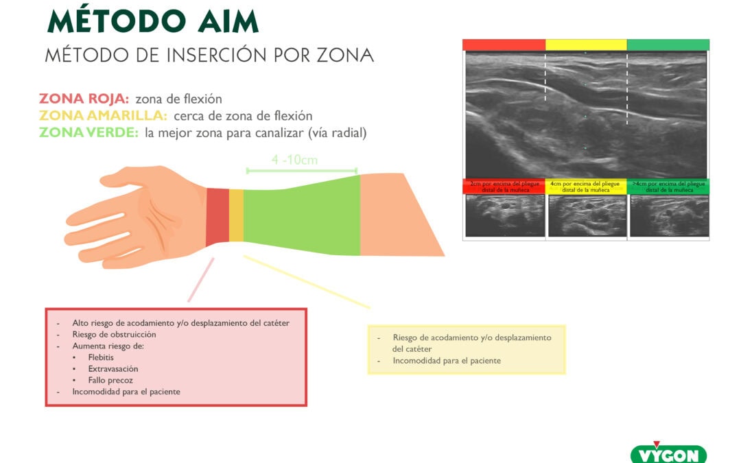 Método AIM