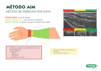 Método AIM