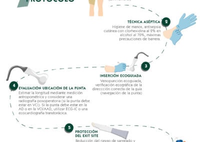Protocolo SIF. Inserción segura de catéter femoral