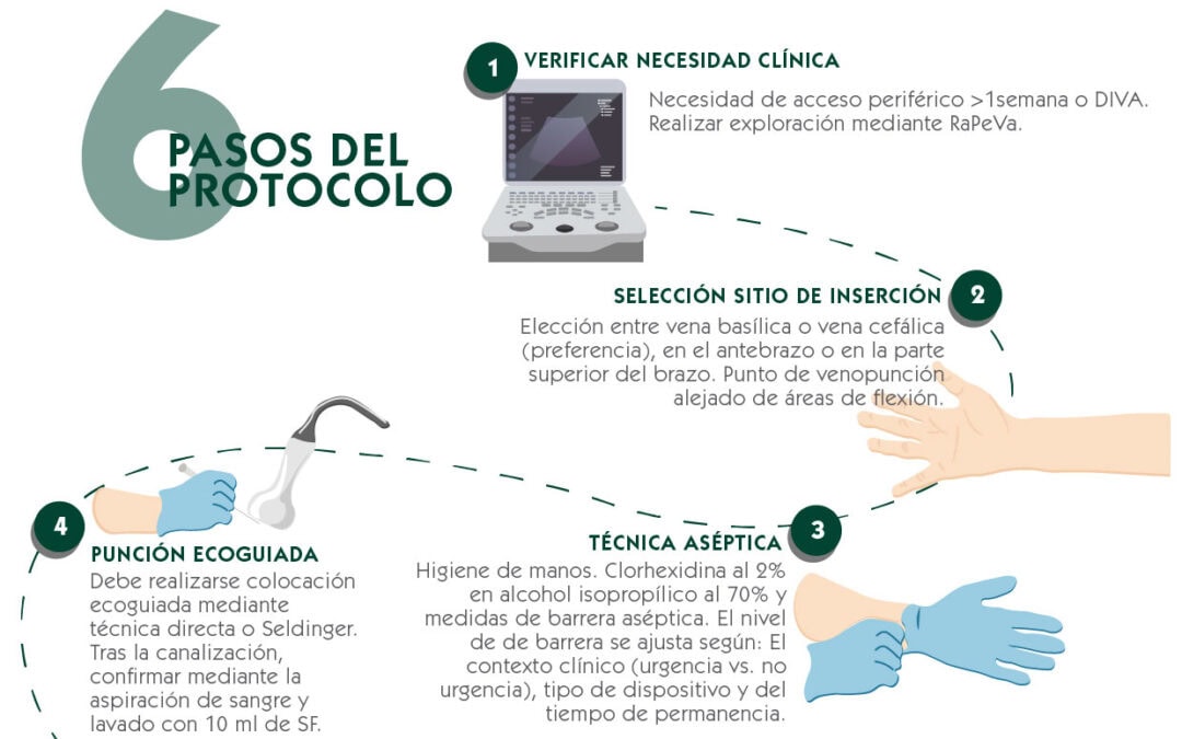 Protocolo SILPeC. Inserción segura de cánula periférica larga (mini-midline)