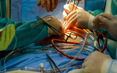 Anastomosis coronaria: claves prácticas para optimizar la revascularización con prótesis arteriales